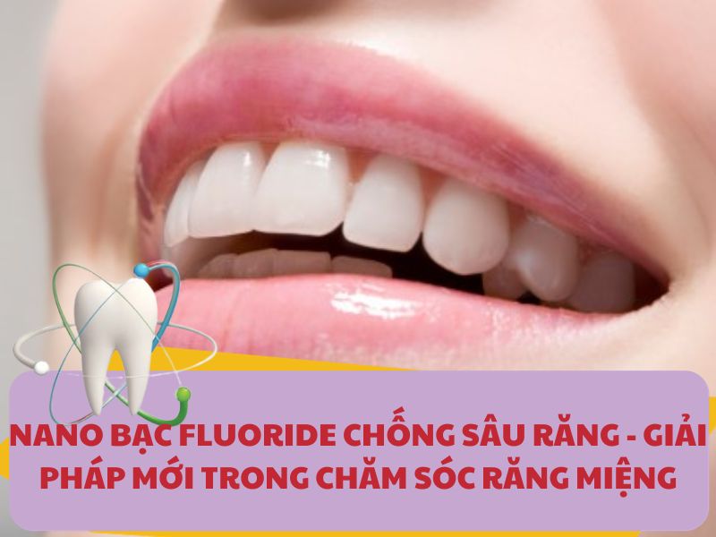 nano-bac-fluoride-chong-sau-rang-giai-phap-moi-trong-cham-soc-rang-mieng-2