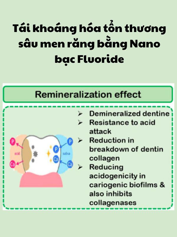 nano-bac-fluoride-chong-sau-rang-giai-phap-moi-trong-cham-soc-rang-mieng-5