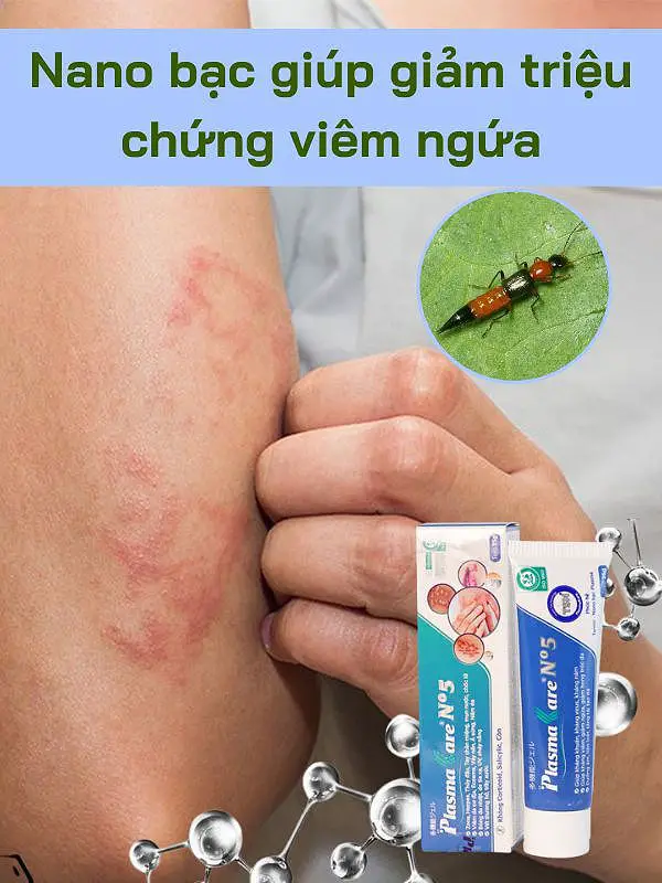 Gel nano bạc an toàn cho mọi đối tượng